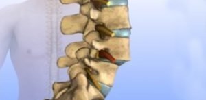 spinal operations