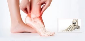 foot ankle surgery