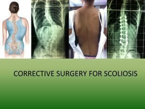 scoliosis correction